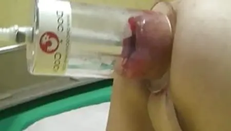 XXL Anal Vacuum Pumping And Fisting