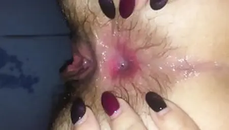 Wife Dirty Anal With Incredible GAPE