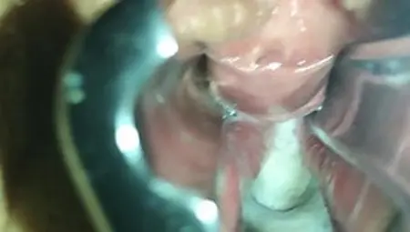 GF Trying To Cum With Speculum Opening Pussy