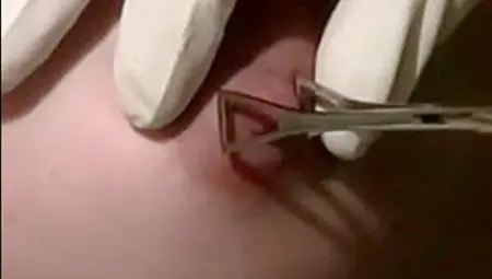 My Sexy Piercings Girls Getting Their Clit Hood Pierced