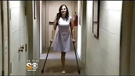 Anna - RHP Amputee On Crutches
