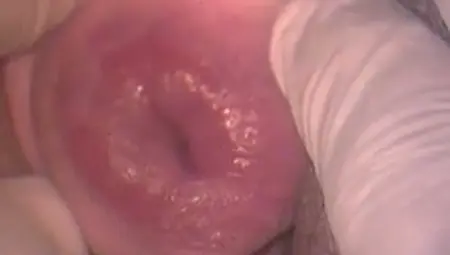 Trashy Hoochie Lets Her Lover Examine Her Swollen Pussy