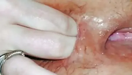 HUSBAND AND WIFE TOYING HAIRY ASSHOLE