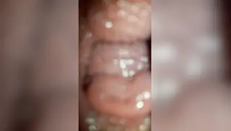 Doggy Open Twat Cervix See