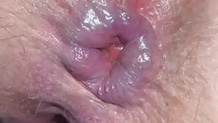 Pierced Cunt Blown Out Bbw Ass Gape And Piss
