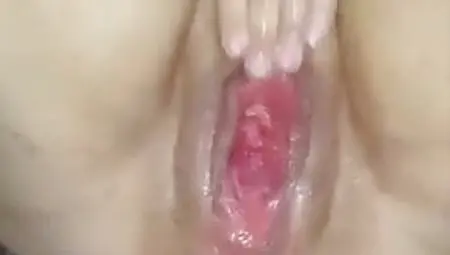 Anal And Vaginal Prolapse From Orgasm