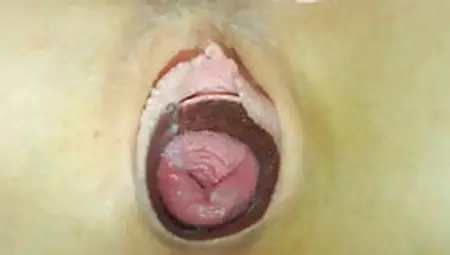Close-up Of Open Cunt, Showing Cervix