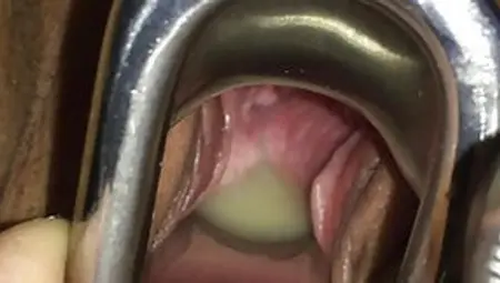 Using A Speculum To Get All The Pussy Juice Out